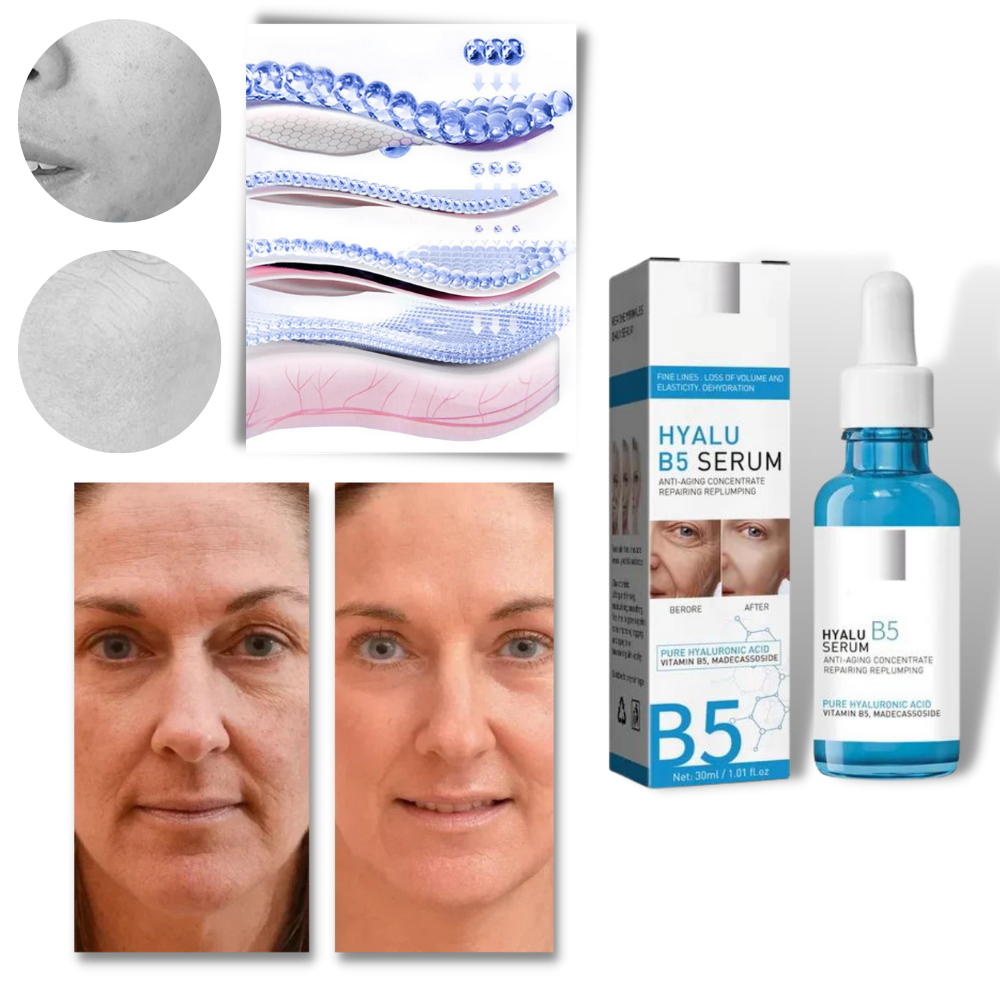 Sérum rajeunissant à l'acide hyaluronique Hyalu B5